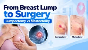 From Breast Lump to Surgery What Actually Happens (Lumpectomy vs Mastectomy Explained)